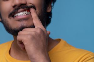 牙周病 3 adult man showing his periodontal disease before t 2021 12 16 20 42 29 utc 1