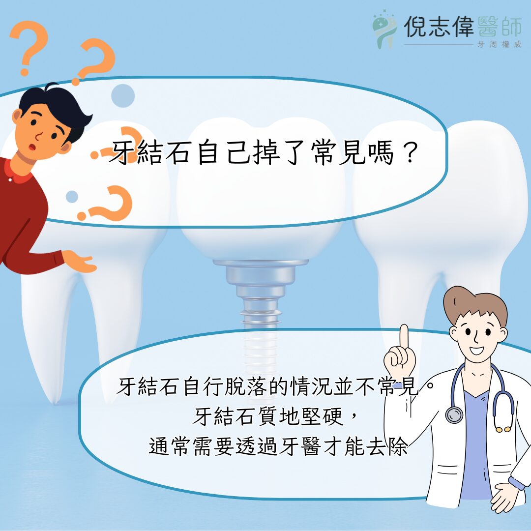 牙結石長怎樣?會不會自己掉下來? 2 牙結石自己掉了常見嗎