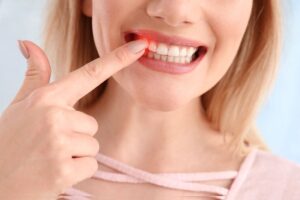 二極體雷射 2 Red Swollen and Bleeding Gums