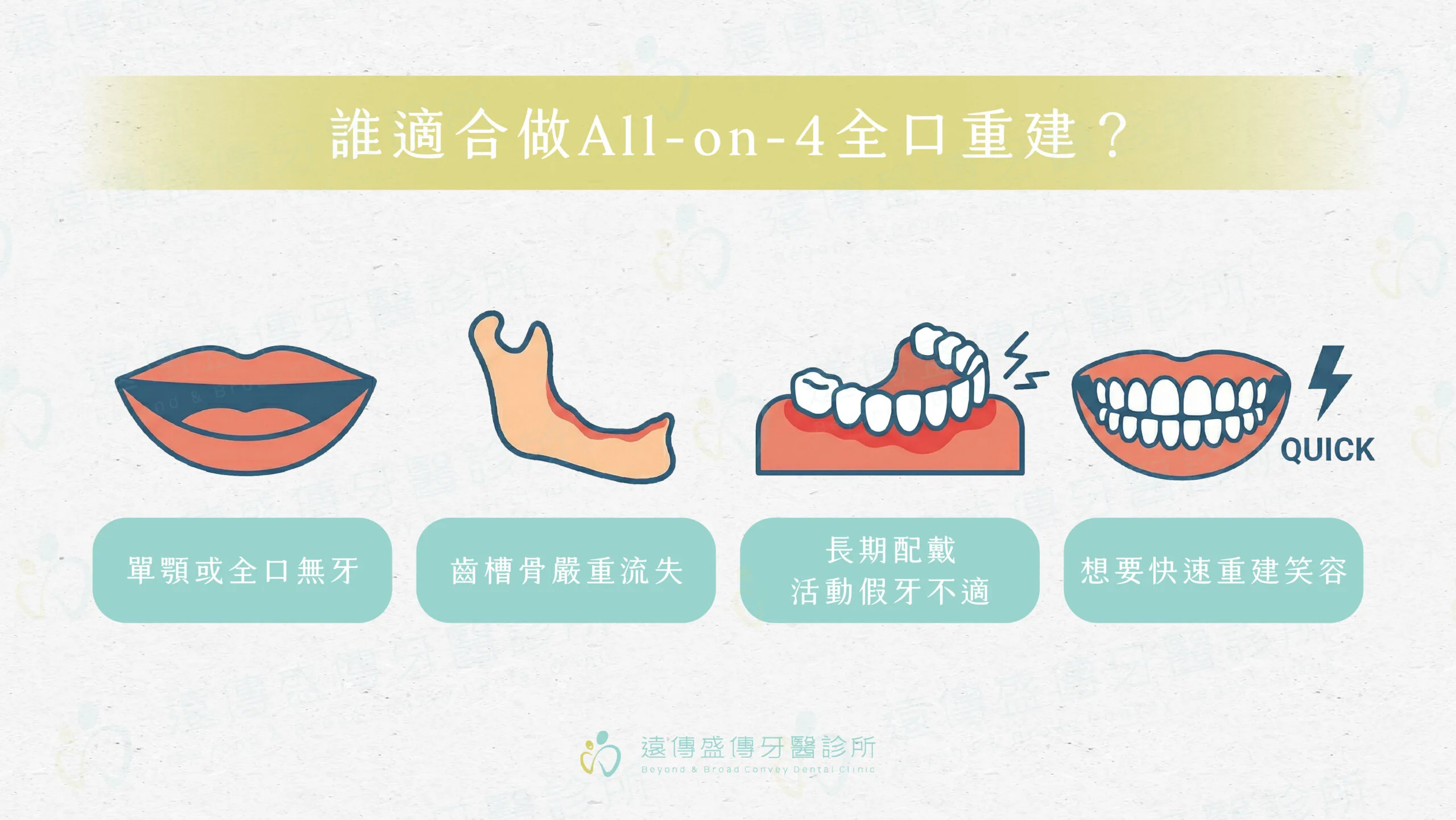 誰適合做All-on-4全口重建？