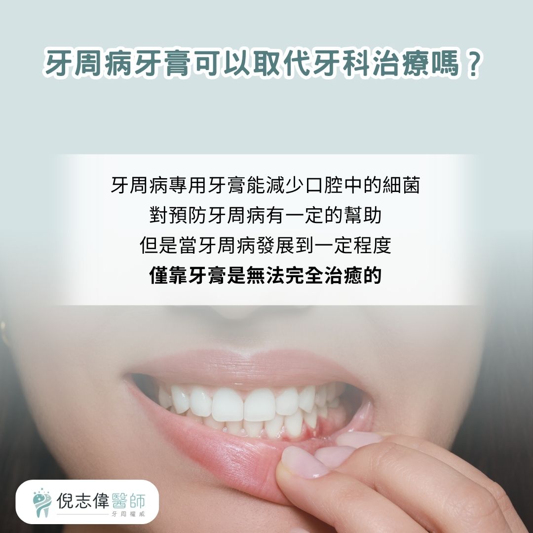 牙周病牙膏可以預防牙周病，但無法取代牙周病治療