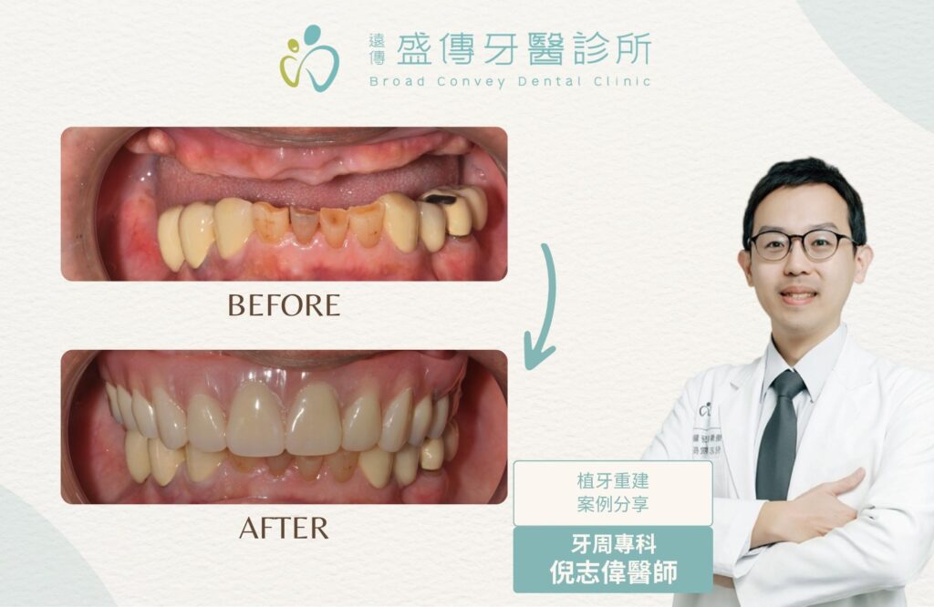 case12w 02