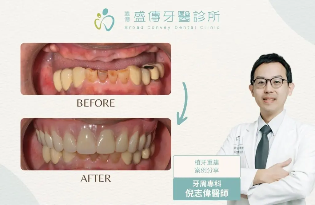 case12w 02