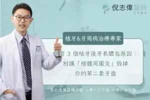 揭密 3 個植牙後牙長膿包原因:別讓「植體周圍炎」毀掉你的第二套牙齒