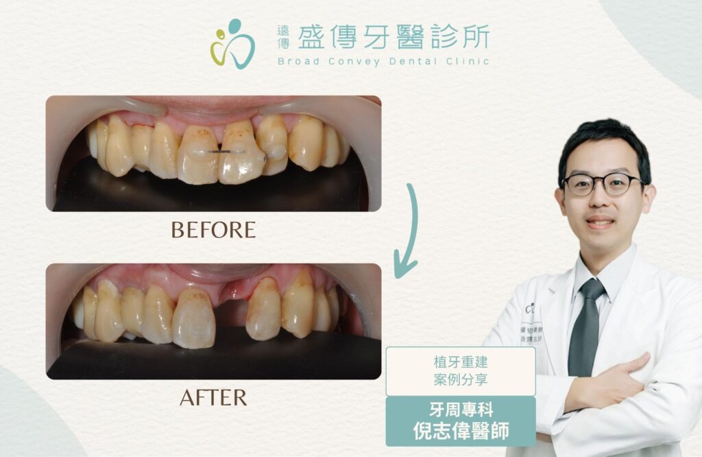 case 13 01