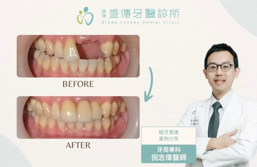 case 14 01