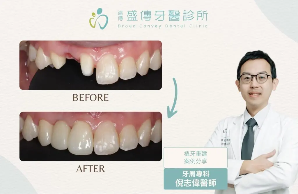 case 17 01