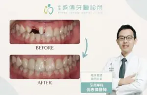 成功案例 9 case 17 02