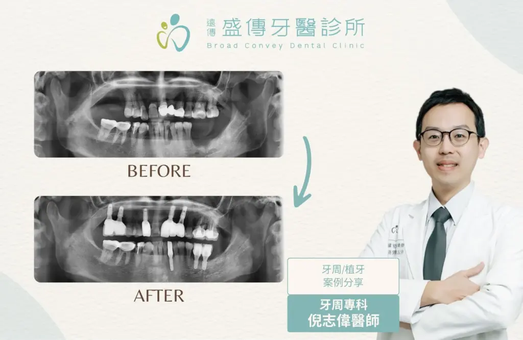 case 18 04 1