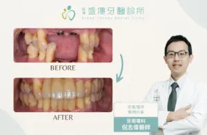 台南牙周病專科|倪志偉醫師 7 case 18 05