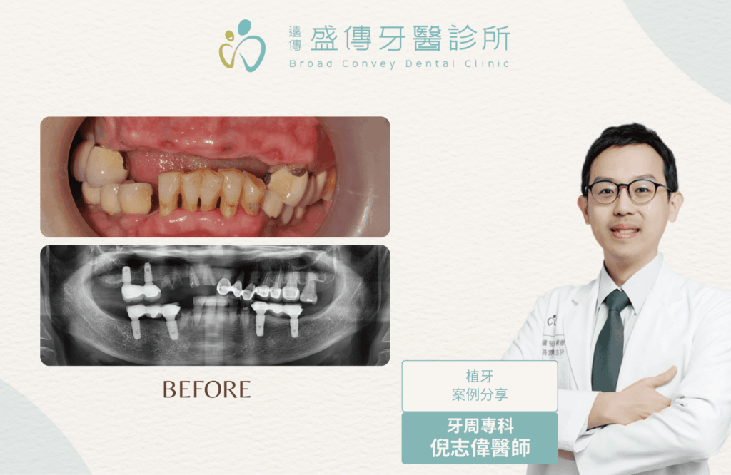 case 20 03