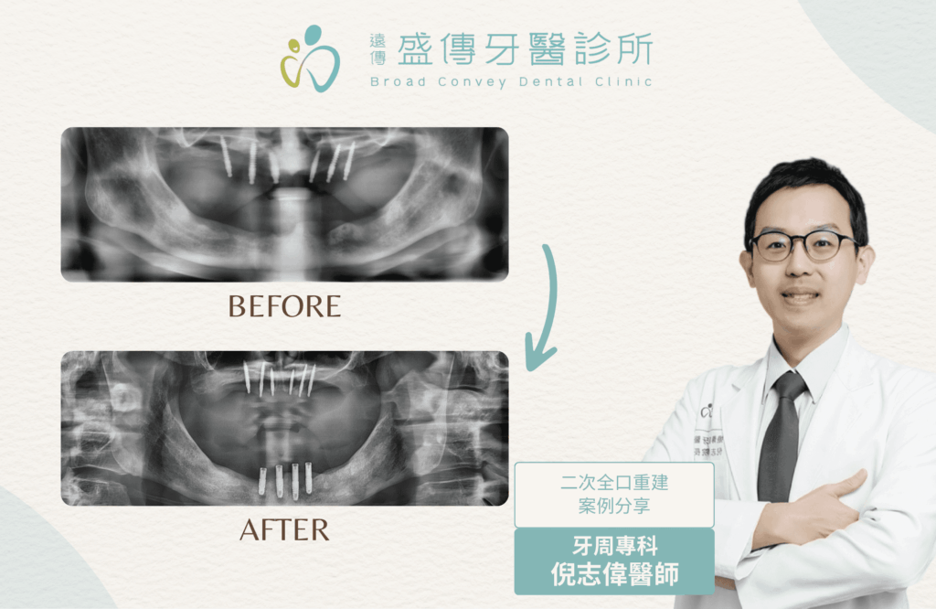 case 21 01