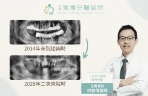 成功案例 11 case 21 03