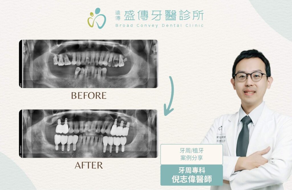case 26 03