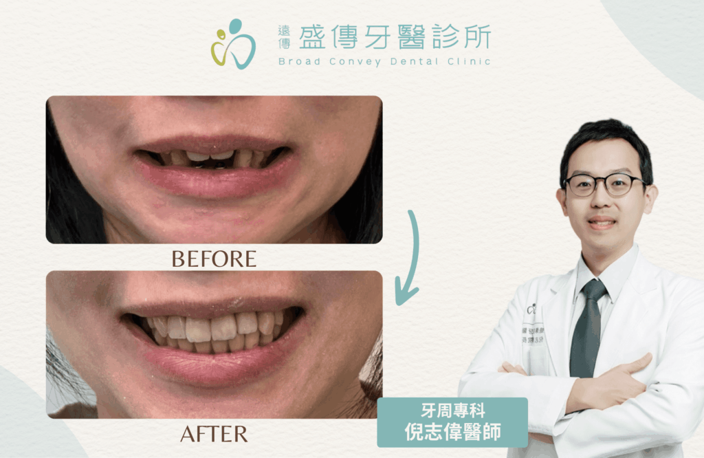 case 26 04