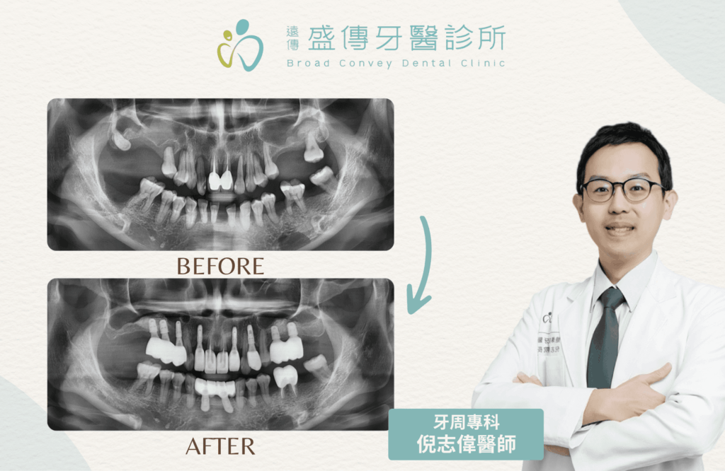 case 26 05