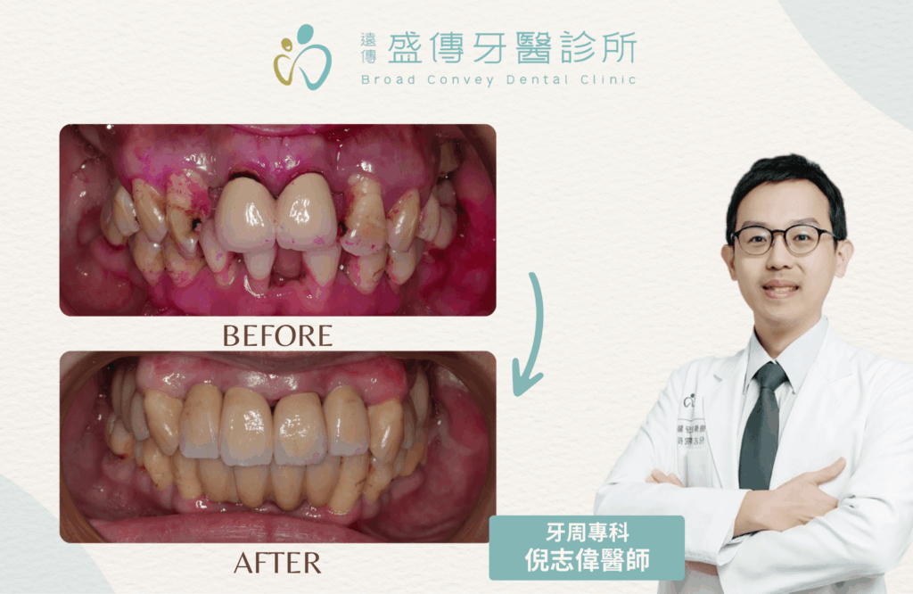 case 26 06