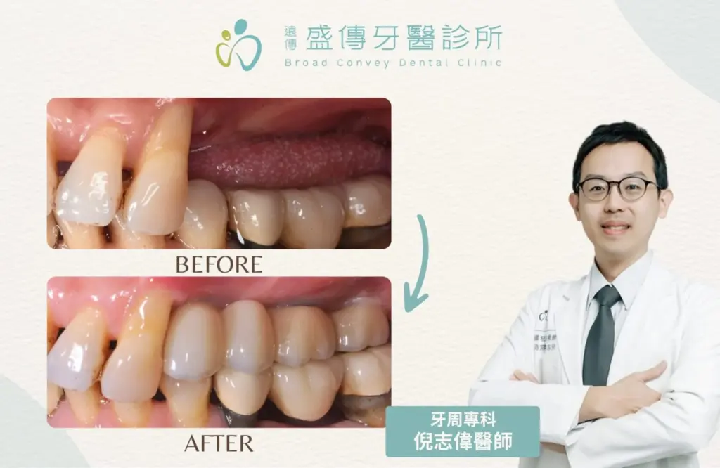 case 28 03