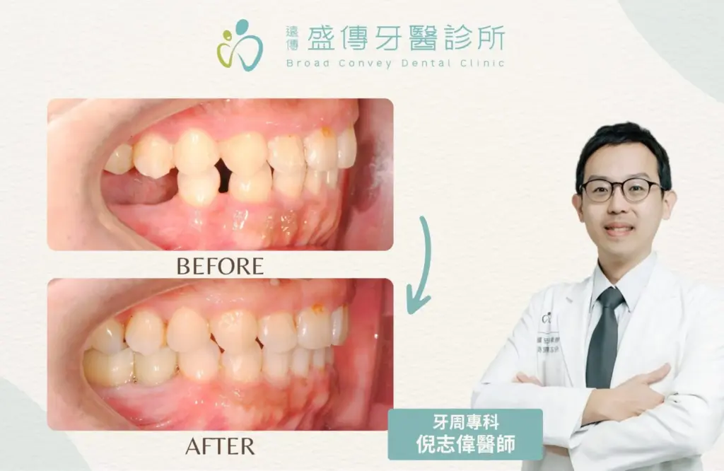 case 29 02