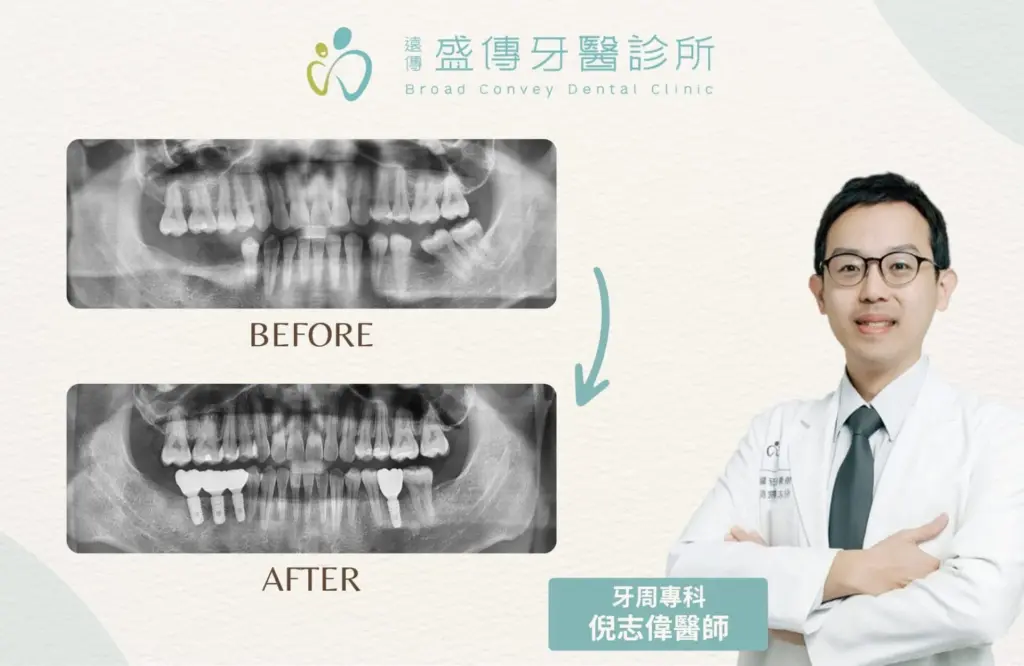 case 29 03