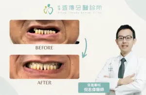 台南牙周病專科|倪志偉醫師 5 case 30 02