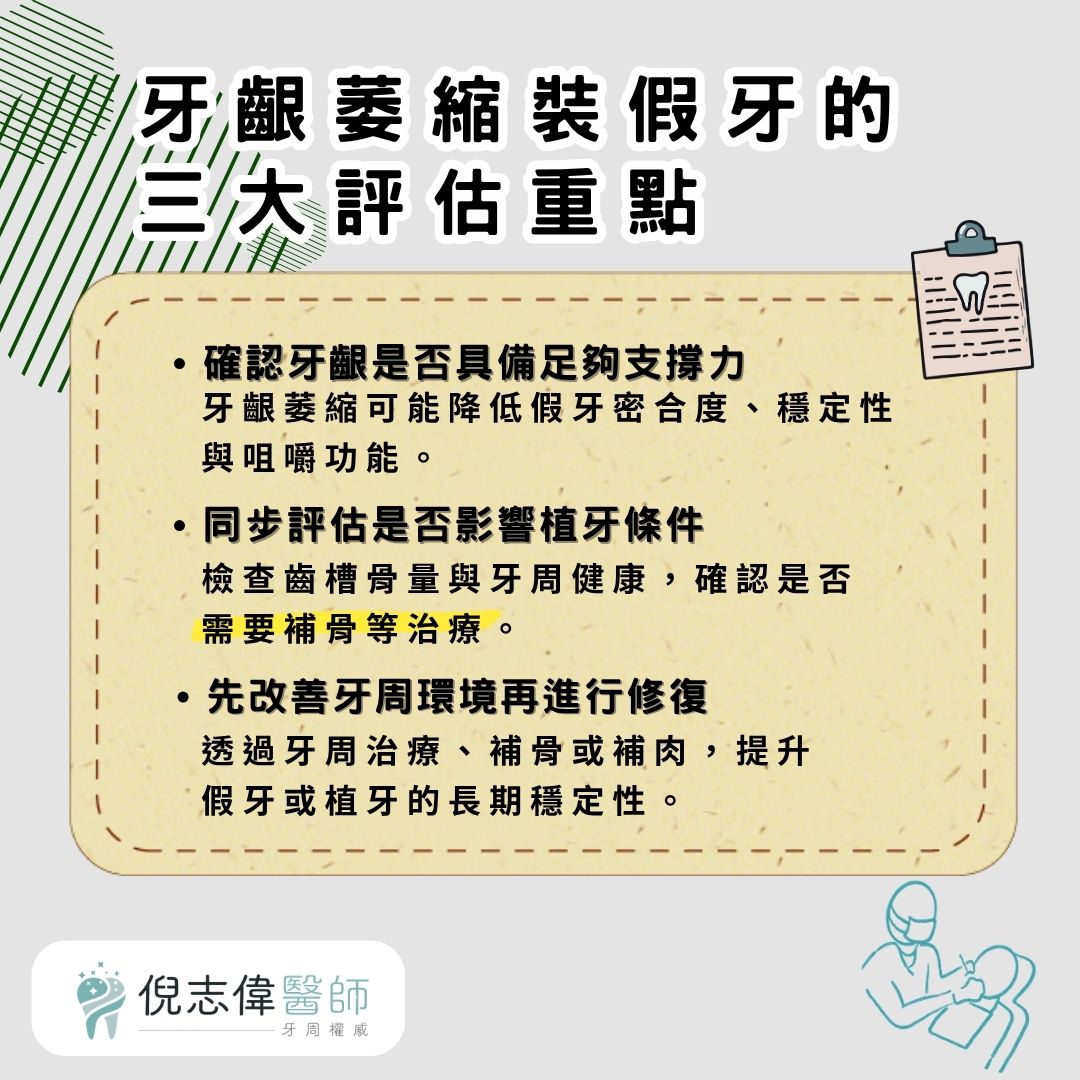 植牙活動假牙比較怎麼看?從牙周條件選擇合適方案 1 牙齦萎縮裝假牙的三大評估重點