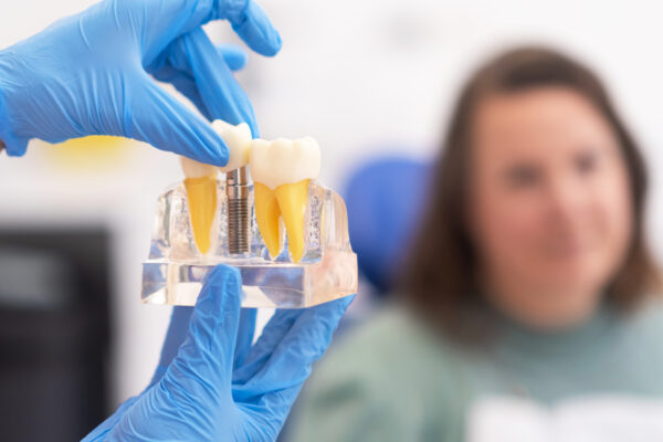 Dental implant model in modern clinic: showing teeth implantation and crown, healthy teeth treatments.